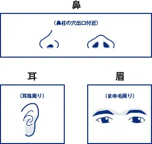 ゴリラクリニックのみだしなみ脱毛部位