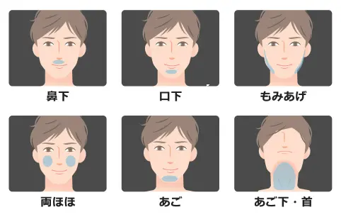 メンズクリアのヒゲ脱毛可能部位