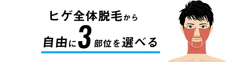 メンズリゼのセレクトヒゲ脱毛