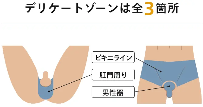 レジーナクリニックオムのVIO箇所